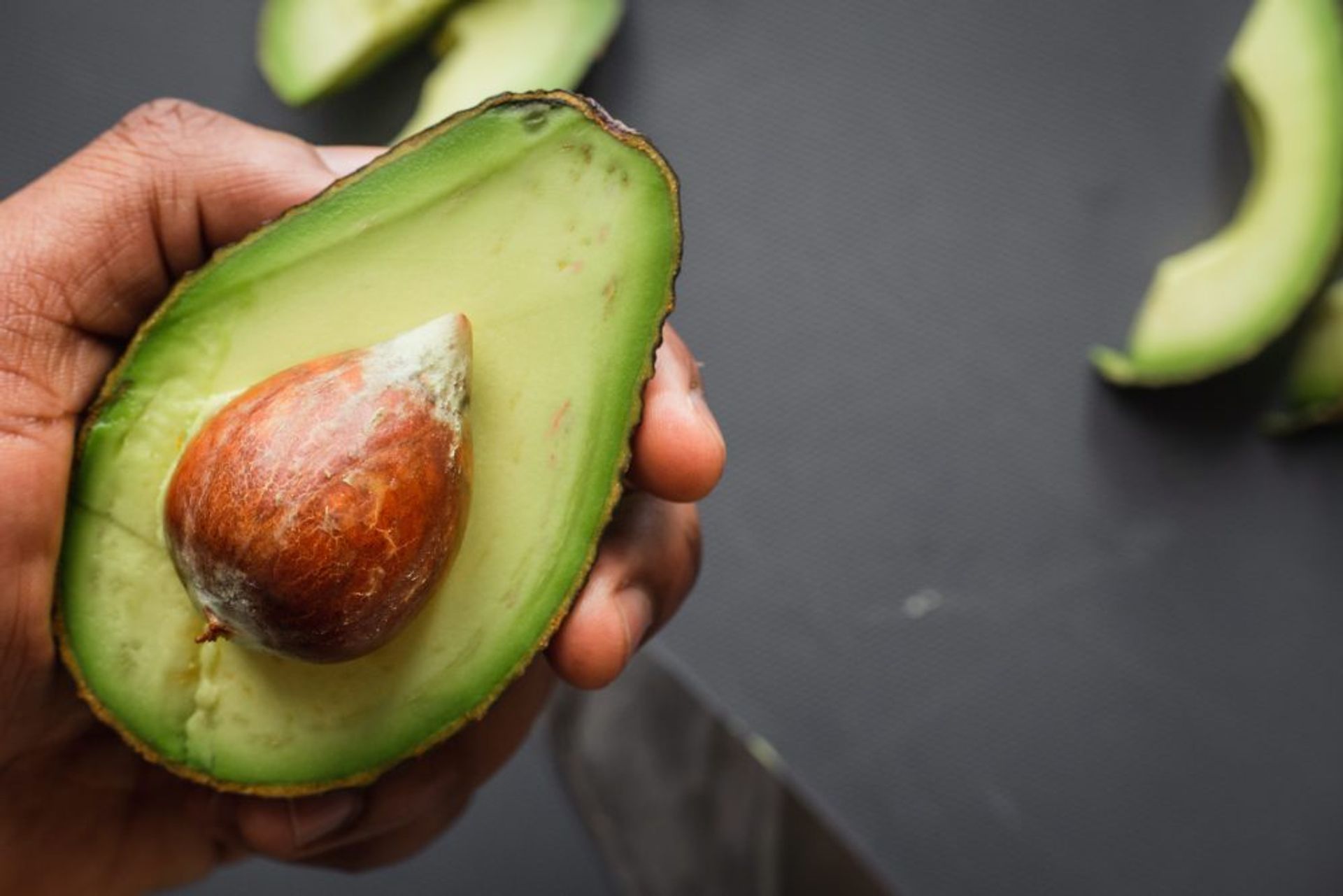 voordelen van een avocado