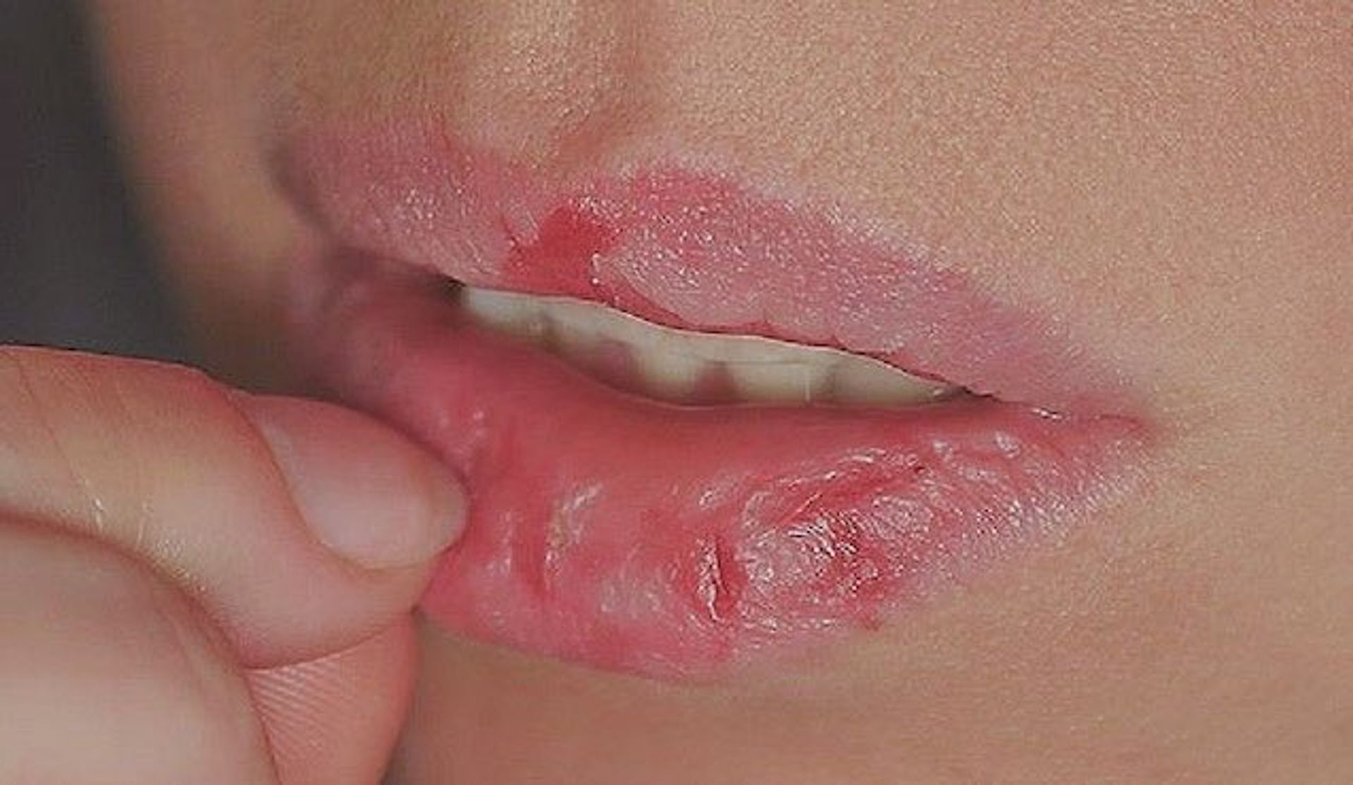 droge-lippen